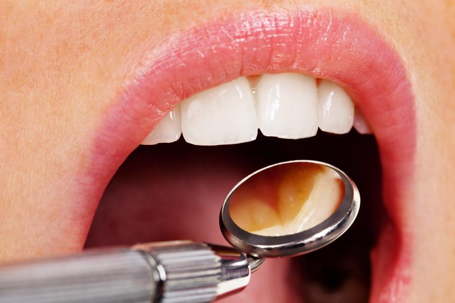 Kontrolle der Zähne durch einen Arzt